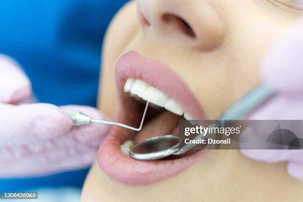 woman having teeth examined at dentists - woman with mouth open stock pictures, royalty-free photos & images