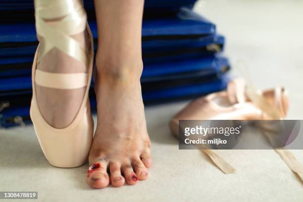 ballerina and her wounded foot after training - ballet feet hurt stock pictures, royalty-free photos & images