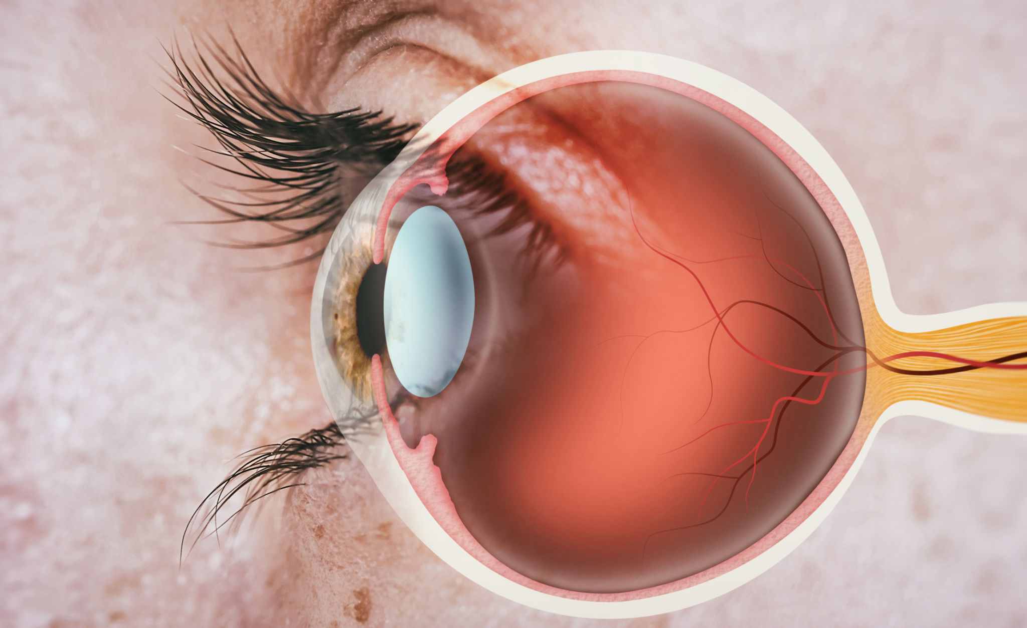 neurological vision