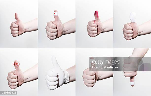 thumbs up in various positions, red string to remember, patch, spray paint, latex gloves, injured, bandaged, thumbs down - bandaged thumb stock pictures, royalty-free photos & images