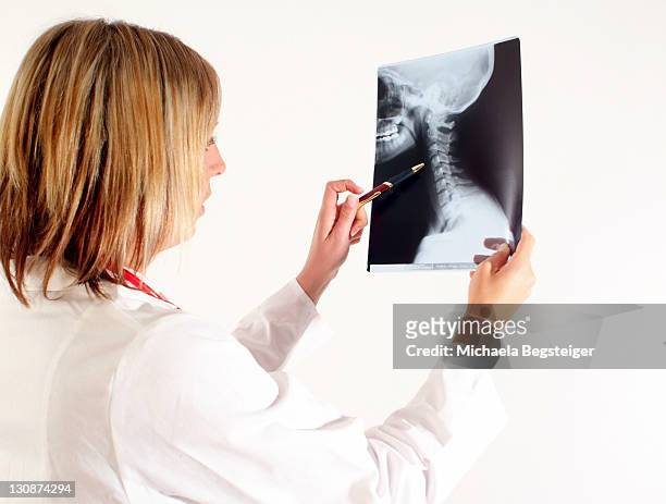woman doctor with x-ray - columna vertebral stock-fotos und bilder