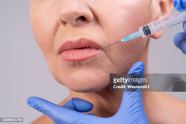 doctor hands injecting woman lip against gray background - lip injections stock pictures, royalty-free photos & images