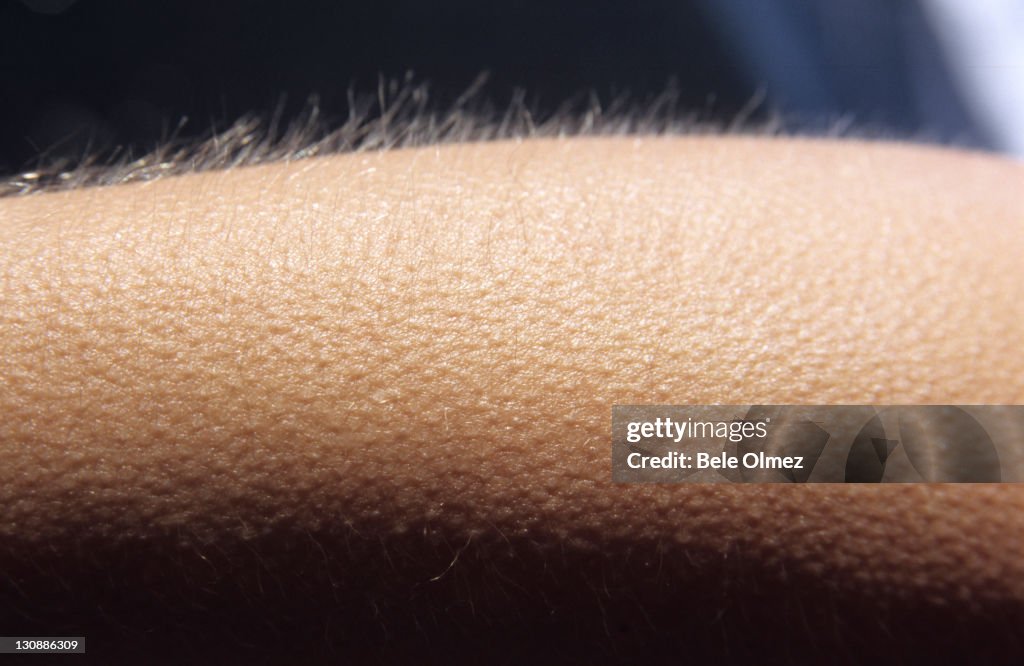 Close-up shot, goosebumps
