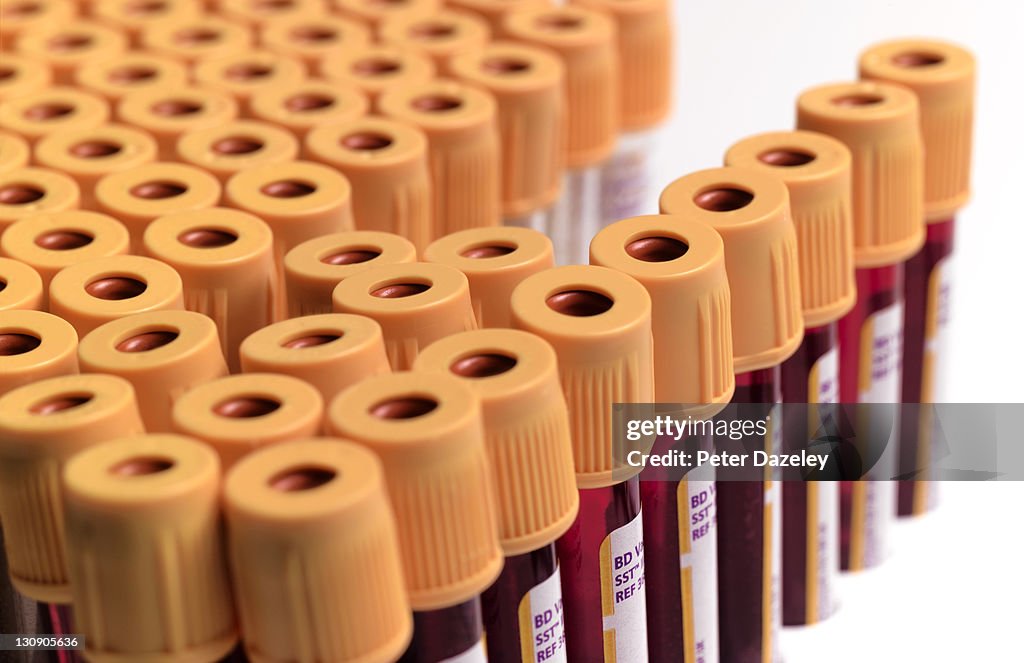 HIV blood samples