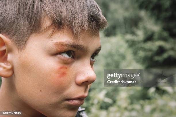 the face of an offended beaten boy with a black eye, sadly looking to the side. domestic violence in the family. unhappy childhood. scar on a bully teenager - black boy ストックフォトと画像