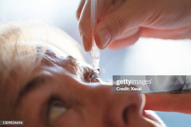 arzt wenden künstliche tränen gel auf seniorin patient auge für die altenpflege - augentropfen stock-fotos und bilder