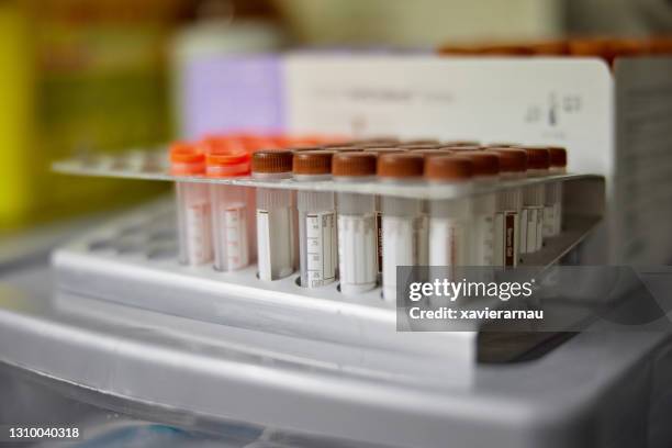 test tube rack in animal hospital - prateleira de tubos de ensaio imagens e fotografias de stock