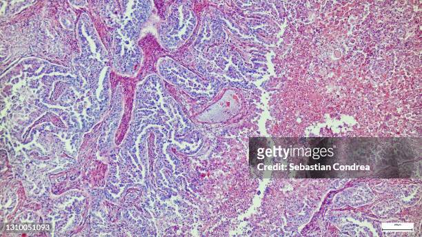 human liver tissue under microscope view for education histology, human tissue - biopsy fotografías e imágenes de stock