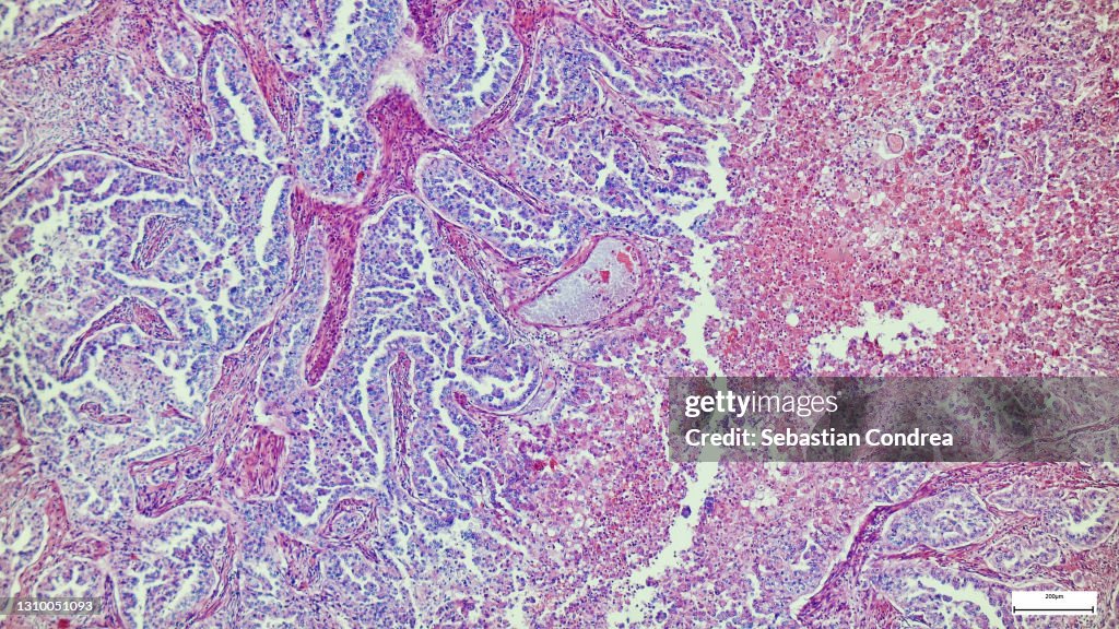 Human liver tissue under microscope view for education histology, Human tissue