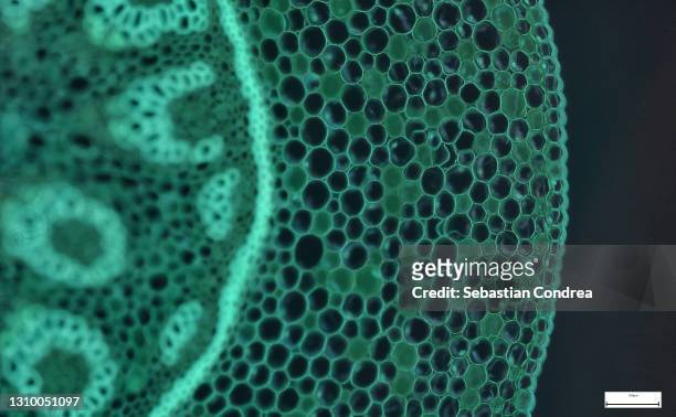 immunofluorescent photomicrograph, organs samples, histological examination, histopathology on the microscope - cancer illness stock pictures, royalty-free photos & images