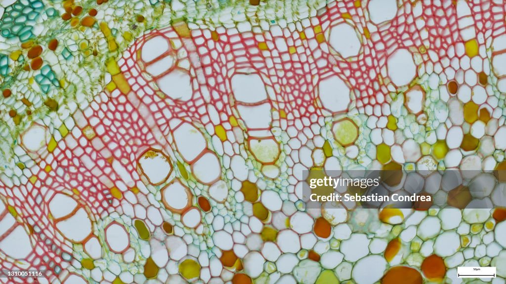 Pteridium aquilinum Dennstaedtiaceae. Immunofluorescent photomicrograph, Organs samples, Histological examination, histopathology on the microscope