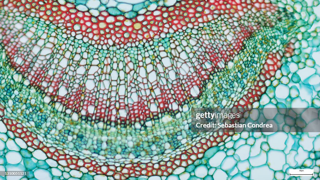Cross section - Xylem is a type of tissue in vascular plants that transports water and some nutrients. Scientific research. Plant tissue StructureImmunofluorescent photomicrograph, Organs samples, Histological examination, histopathology on the microscope