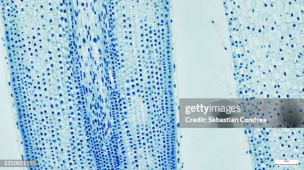 microscopic view of cells of broad bean plant. immunofluorescent photomicrograph, organs samples, histological examination, histopathology on the microscope - cell structure stockfoto's en -beelden