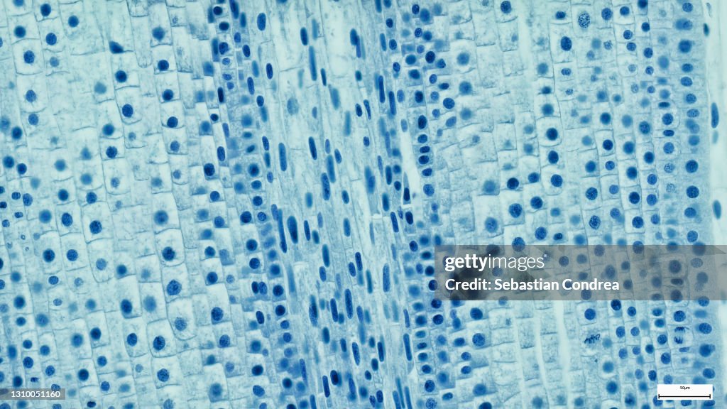 Onion epidermis with large cells under microscope.