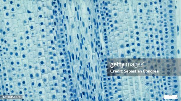 onion epidermis with large cells under microscope. - microscope bildbanksfoton och bilder