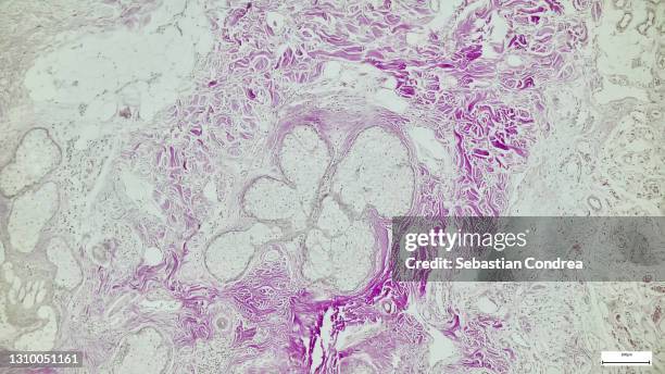 immunofluorescent photomicrograph, organs samples, histological examination, histopathology on the microscope - morfologia imagens e fotografias de stock