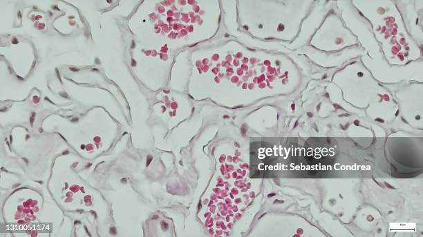 immunofluorescent photomicrograph,microscopic photograph of a professionally prepared slide of liver tissue. the liver is divided histologically into lobules. organs samples, histological examination, histopathology on the microscope - blood veins stock pictures, royalty-free photos & images