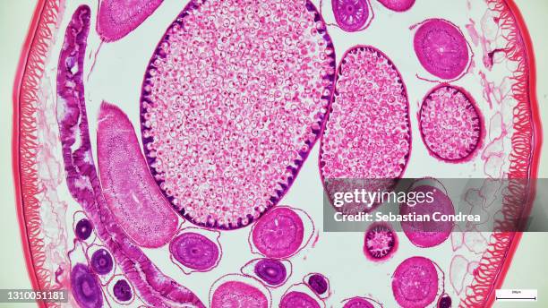 high resolution cross section of ascaris, giant roundworm, parasitic worm in humans. - cellulose stockfoto's en -beelden