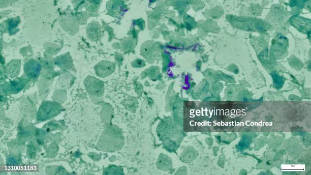 lung tongue at the immunofluorescent photomicrograph, organs samples, histological examination, histopathology on the microscope - hematoxylin and eosin staining stockfoto's en -beelden