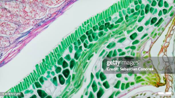 histological evaluation of the developing trabecular bone. goldner's trichrome staining with the blue/green colour representing mineralized tissue. immunofluorescent photomicrograph, organs samples. - biopsy fotografías e imágenes de stock