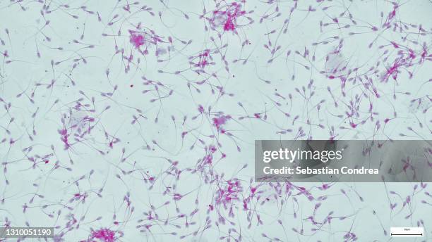 sperm cells or spermatozoa, immunofluorescent photomicrograph, organs samples, histological examination, histopathology on the microscope - mikroskop stock-fotos und bilder