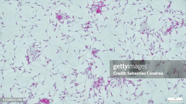 sperm cells or spermatozoa, immunofluorescent photomicrograph, organs samples, histological examination, histopathology on the microscope - sperm stock pictures, royalty-free photos & images