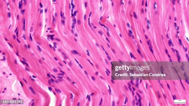 tendons have high tensile strength, light micrograph.immunofluorescent photomicrograph, organs samples, histological examination, histopathology on the microscope - hematoxylin and eosin staining stockfoto's en -beelden