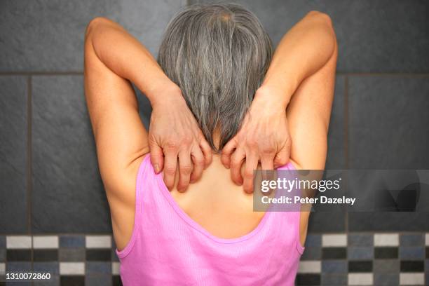 women scratching back - gordelroos stockfoto's en -beelden