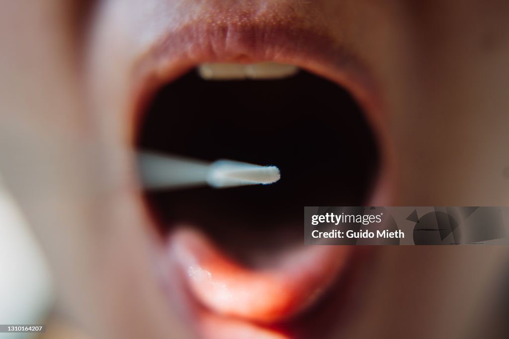 Rapid test for infectious disease in open mouth.