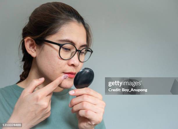 woman looking her face by mini mirror while applying an antiviral cream or ointment to treat herpes labialis on her lower lip. - herpes labial - fotografias e filmes do acervo