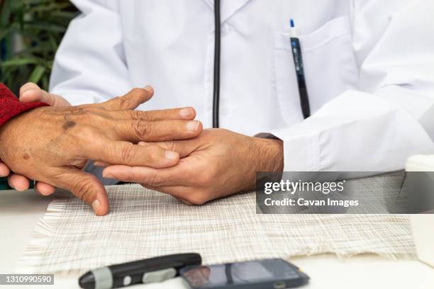 doctor examining the hand of an elderly man with osteoarthritis - rheuma stock-fotos und bilder