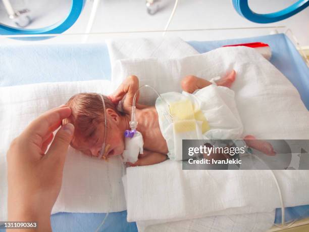 preterm baby in nicu - premature baby stock pictures, royalty-free photos & images