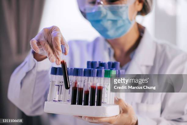 asian chinese cosmetologist does prp therapy and working on platelet-rich-plasma therapy using centrifuge machine holding blood collection tube - blood stock pictures, royalty-free photos & images