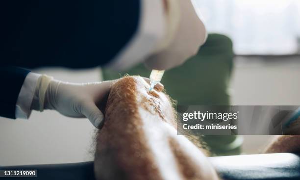 doctor is taking out knee fluid from patient's knee with a syringe - knee injection stock pictures, royalty-free photos & images