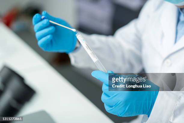 a pair of hands held a nasopharyngeal swab - coronavirus test foto e immagini stock
