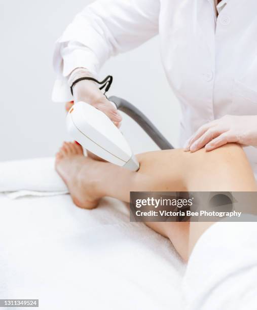 woman getting laser treatment on her legs, beauty concepts, medical laser. - cirugía láser fotografías e imágenes de stock