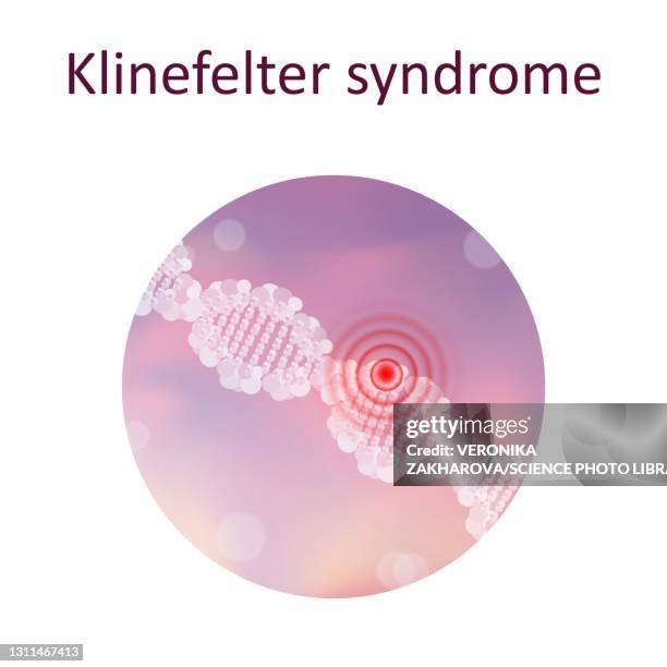 ilustraciones, imágenes clip art, dibujos animados e iconos de stock de klinefelter syndrome, illustration - nucleótido