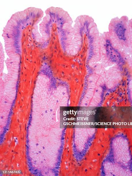 stomach surface epithelium, lm - gastric pit stock pictures, royalty-free photos & images