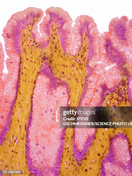 stomach surface epithelium, lm - gastric pit stock pictures, royalty-free photos & images