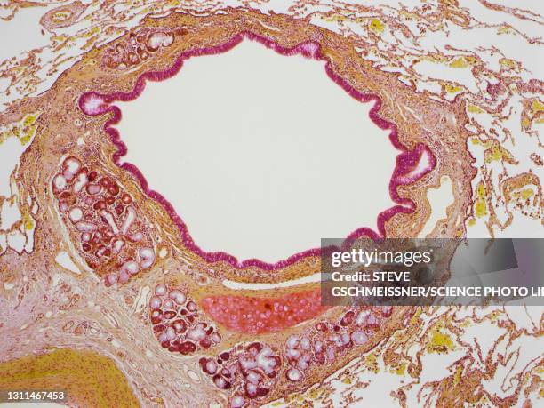 lung bronchiole, lm - smooth muscle microscope stock pictures, royalty-free photos & images