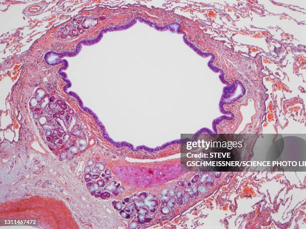 lung bronchiole, lm - light micrograph stock-fotos und bilder