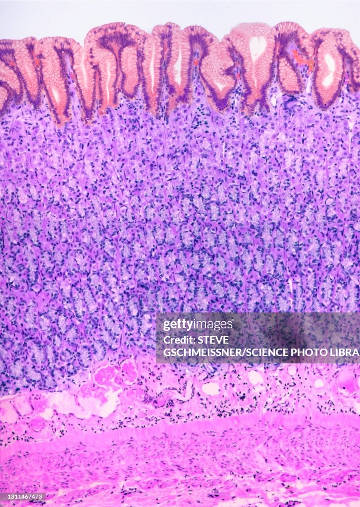 Stomach lining, LM