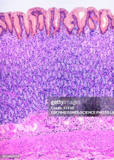 stomach lining, lm - gastric pit stock pictures, royalty-free photos & images