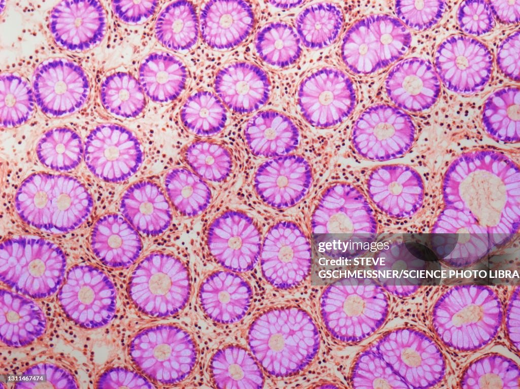 Crypts of Lieberkuhn, LM