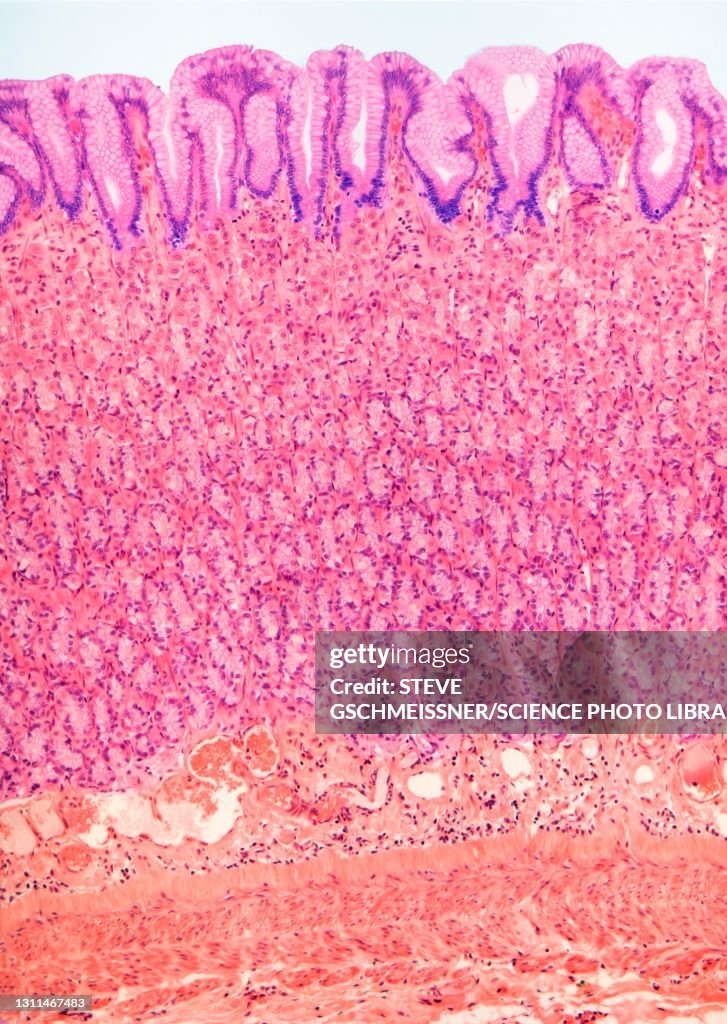 Stomach lining, LM