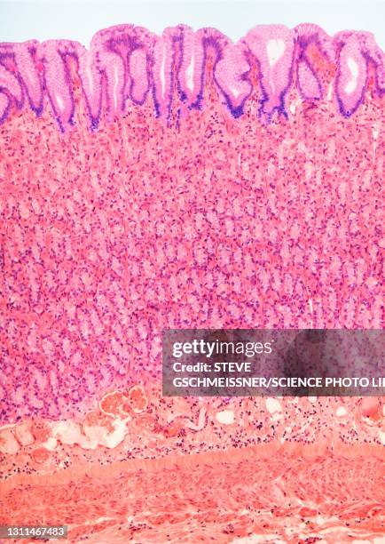 stomach lining, lm - gastric pit stock pictures, royalty-free photos & images