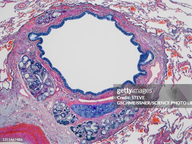 lung bronchiole, lm - smooth muscle microscope stock pictures, royalty-free photos & images