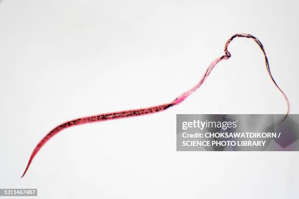 whipworm, light micrograph - nematodes stock pictures, royalty-free photos & images