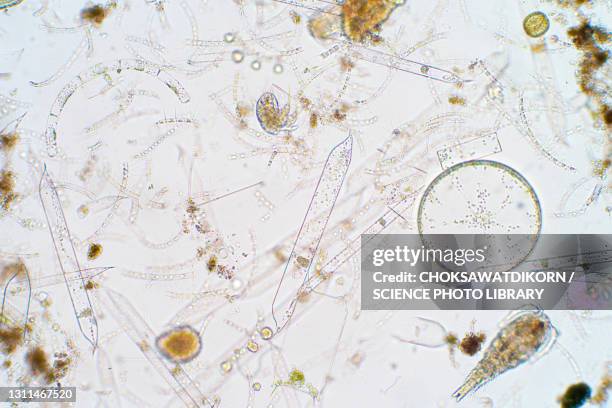 marine plankton, light micrograph - plancton photos et images de collection