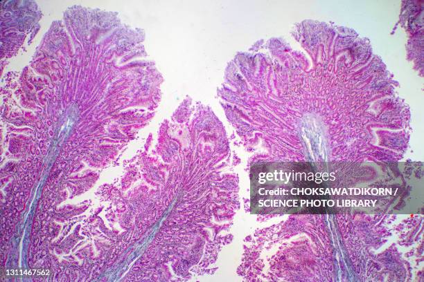 human large intestine tissue, light micrograph - lichtmicroscopische-foto stockfoto's en -beelden
